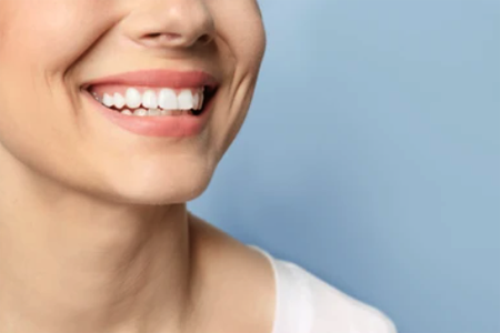 Улыбка с отбеленными зубами в стоматологии